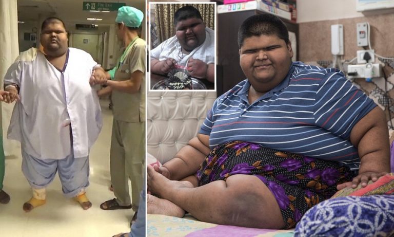 विश्वको सबैभन्दा मोटो बच्चा, उमेर १४ वर्ष तौल २ सय ७३ किलो