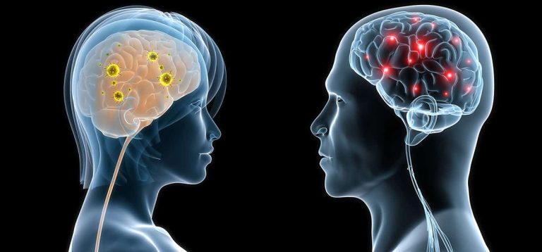 महिलाको मस्तिष्क पुरुषको तुलनामा उत्कृष्ट, किन चल्छ  धेरै ?