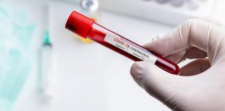 म्यारिज एनिभर्सरी मनाउन जम्मा भएका ३५ नेपाली कोरोनाभाइरस संक्रमित, एकको अवस्था गम्भीर