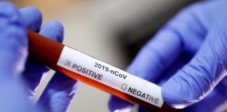 बाग्लुङकी कोरोना संक्रमित ६५ वर्षीया महिलाको तेस्रो परीक्षण नेगेटिभ