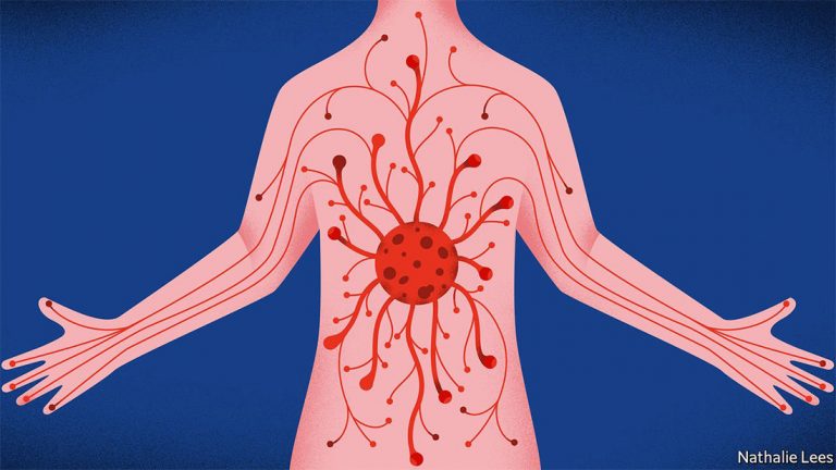 कोरोनाका नयाँ लक्षण, यस्तो देखिए तत्काल अलग्गै बस्नुहोस् !