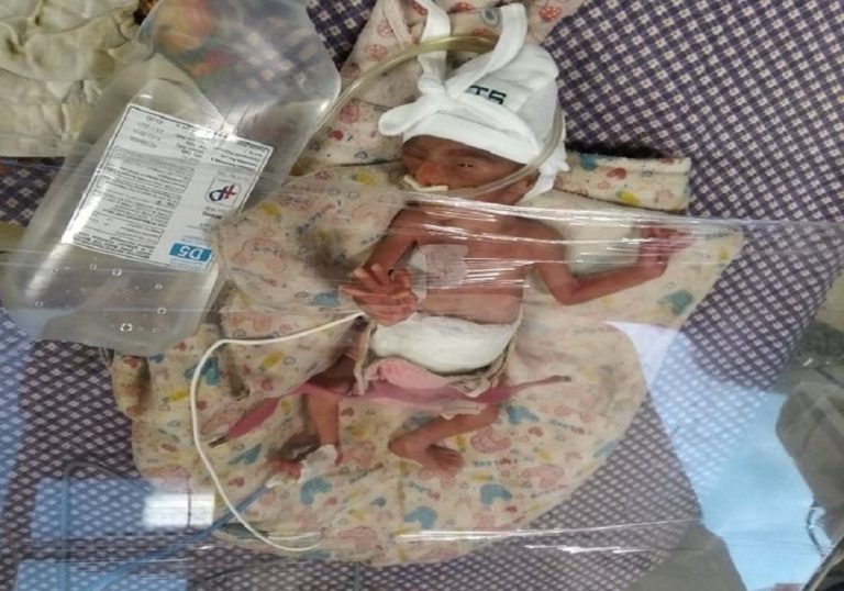 प्रसूति गृहमा मृत घोषणा गरी फ्याँकिएको शिशु ८ घण्टापछि रुन थालेपछि…