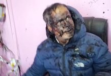 धनकुटा यातायातका प्रमुखमाथि कालोमोसो दलियो, आरोपित फरार–भिडियो भाइरल